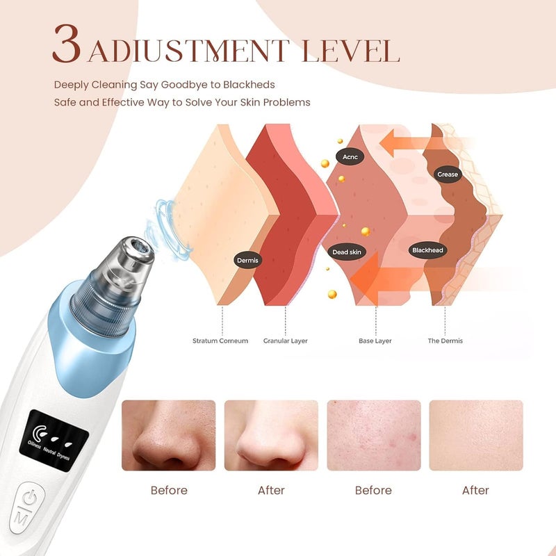Gackoko 2025 Blackhead Remover Pore Vacuum,Facial Pore Cleaner-5 Suction Power,5 Probes,USB Rechargeable Blackhead Vacuum Kit Electric Acne Extractor Tool for Adult - Image 3